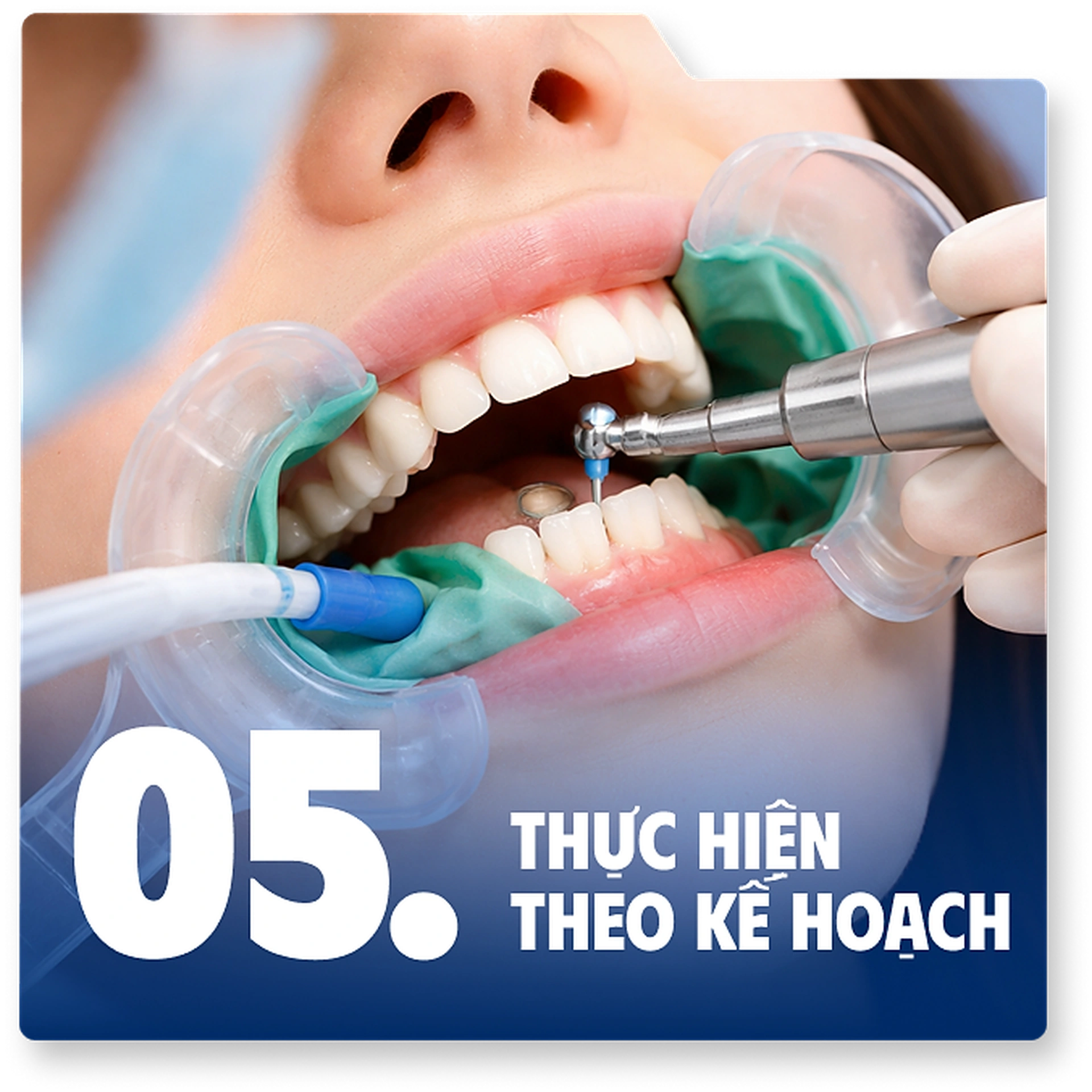 Bước 5: Thực hiện theo kế hoạch